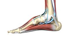 Posterior Tibial Tendon Dysfunction